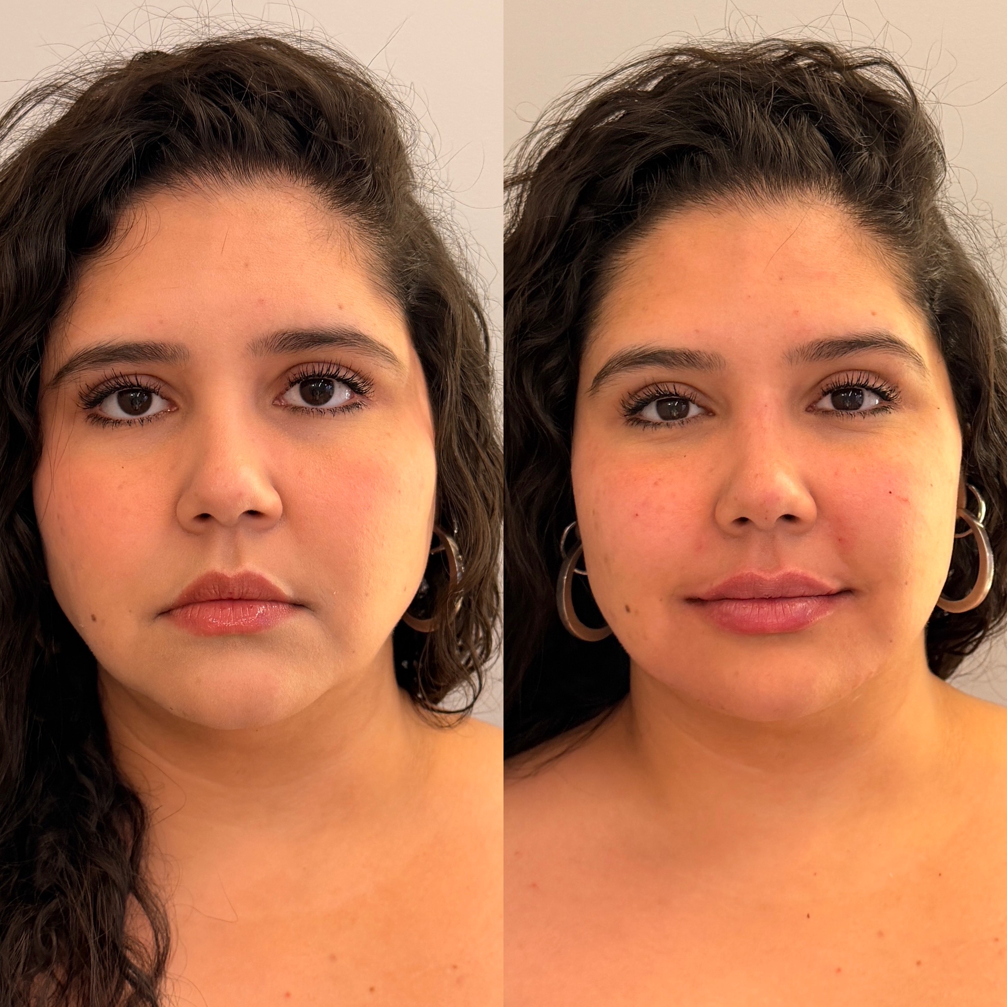 Comparação antes e depois, perfil e leveza natural